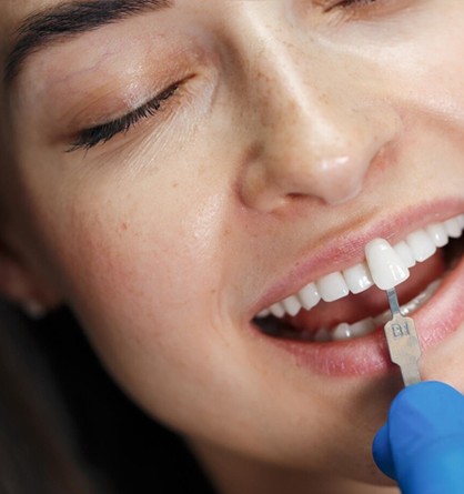 Tam Seramik Kronlar Home